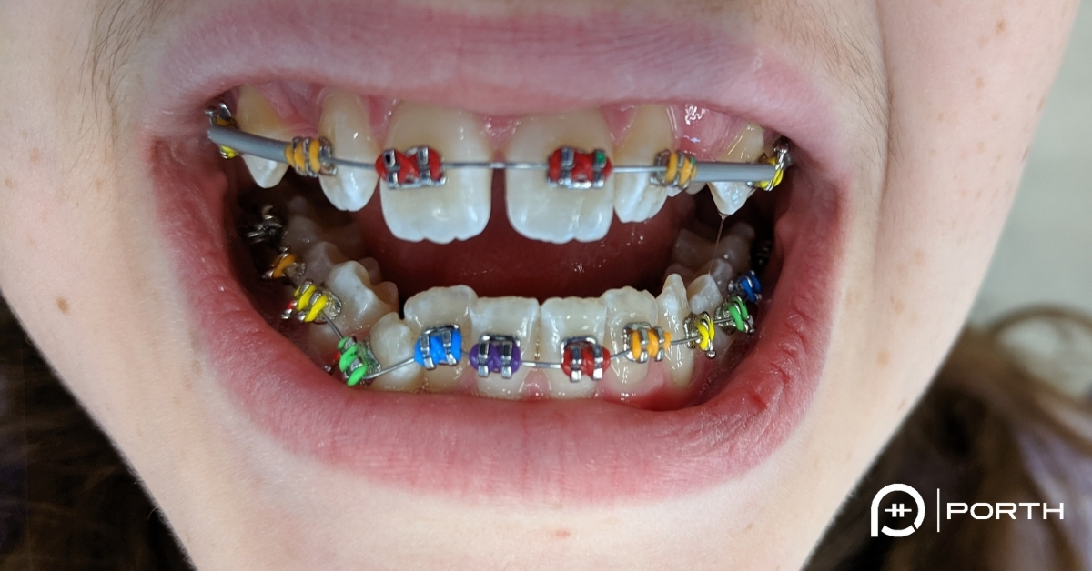 Orthodontist