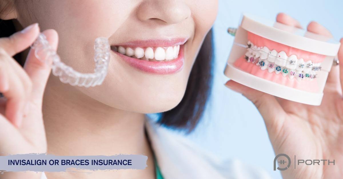 All you need to know about braces insurance - Modern Orthodontic Clinic in  Sammamish & Bellevue