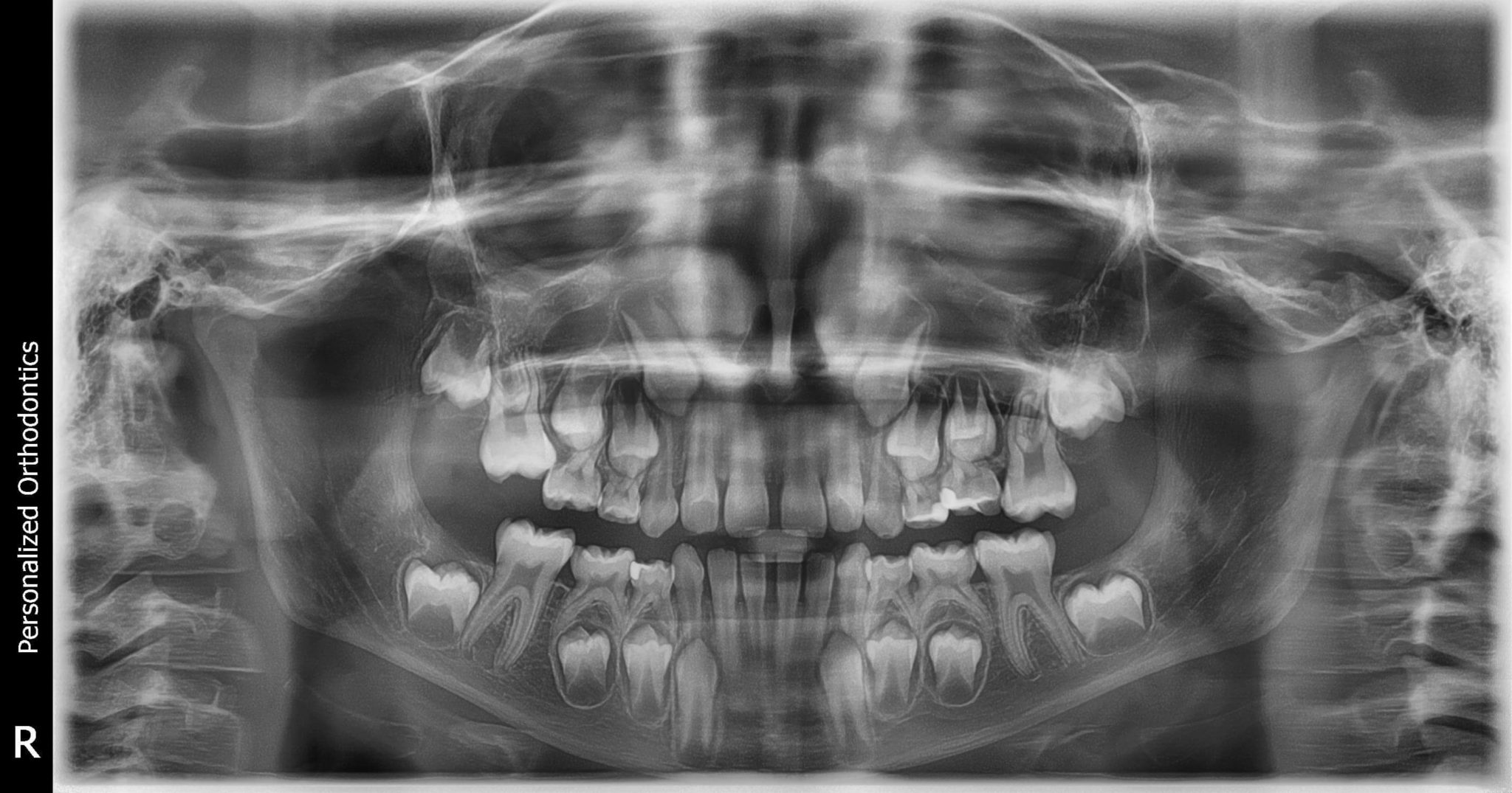 What does happen during your first orthodontic consultation?