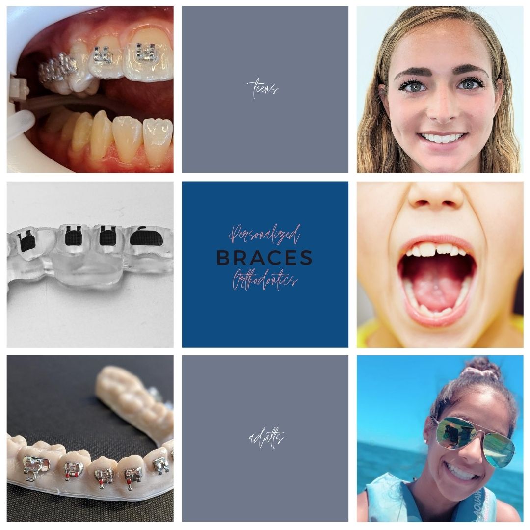 What Does Happen During Your First Orthodontic Consultation