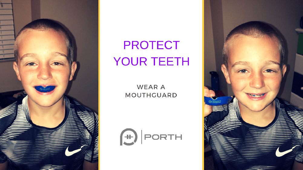 Protect Your Teeth - Wear a Mouthguard. Porth.