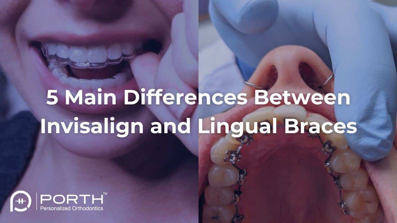 Lingual braces vs invisalign